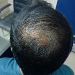 one (39)