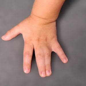 one (6)